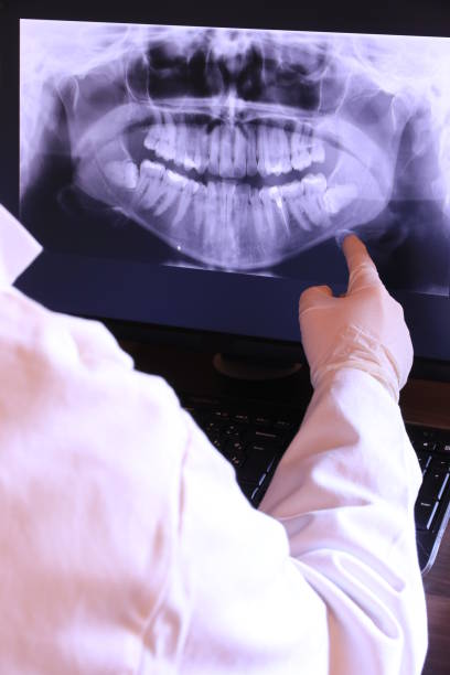 Best Emergency Tooth Extraction in Burley, ID