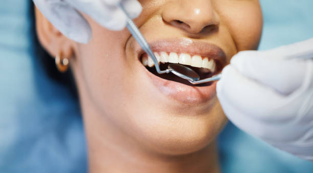 Best Emergency Wisdom Teeth Removal in Burley, ID