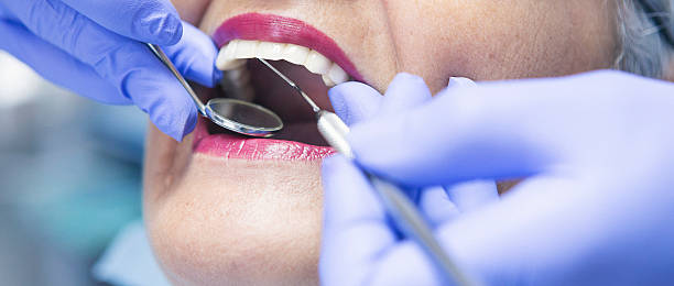 Best Emergency Treatment for Dental Infections or Abscesses in Burley, ID